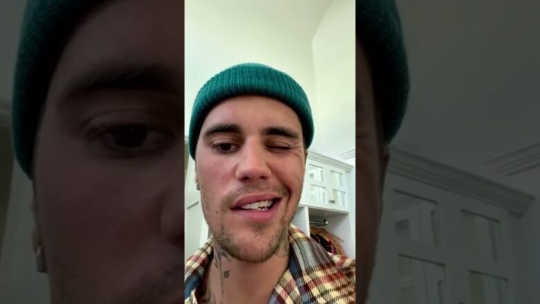 Justin Bieber Regains Face Mobility | What’s Trending Explained | #shorts
