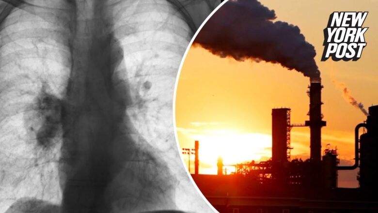 Air pollution ‘wakes up’ cancer cells in non-smokers’ lungs: study | New York Post