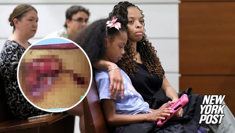 Jury awards 8-year-old girl $800K after she got 2nd-degree burns from McDonald’s chicken nugget