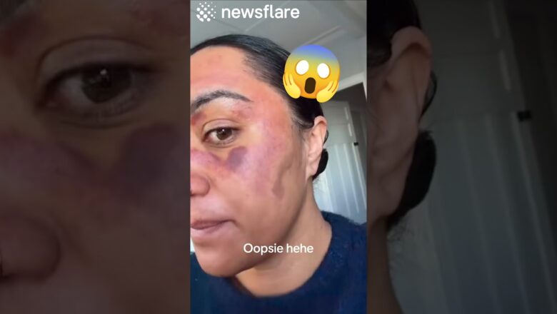 Skincare Routine Turns Into Disaster