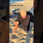 Bald Man Uses Beach For Hair Transplant