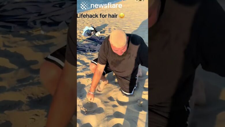 Bald Man Uses Beach For Hair Transplant
